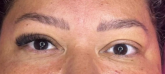 Antes e Depois Cílios